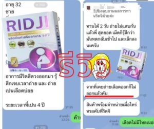 ริดสีดวงทวาร